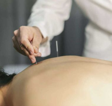 akupunktura v termah Laško