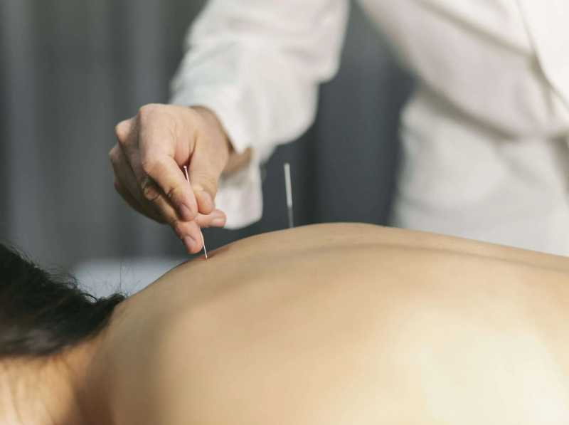 akupunktura v termah Laško